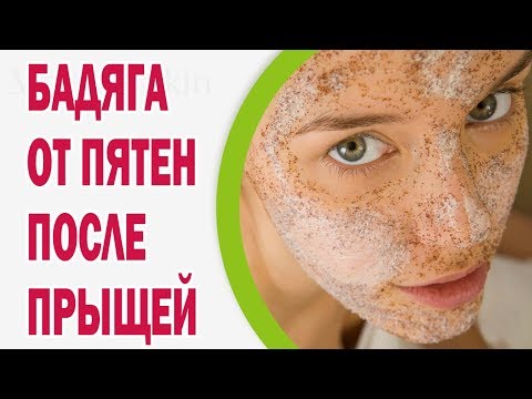 Глина для лица отбеливает Маска от пигментных пятен с глицерином