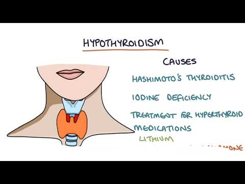 Hypothyreose und Hashimoto-Thyreoiditis: Visuelle Erklärung für Studenten