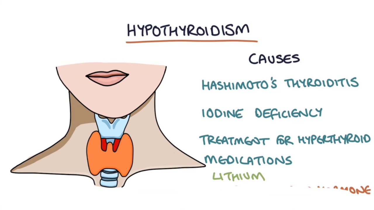 Hypothyroidism and Hashimoto's Thyroiditis: Visual Explanation for Students