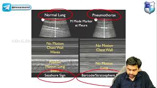 Focused Assessment With Sonography in Trauma (FAST)