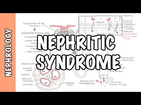 Nephritic Syndrome - Types, Classification, Pathophysiology, Treatment (RPGN, ANCA, Immune Complex)