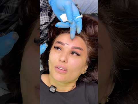 Sona qədər izlə #microblading #kesfet #botox