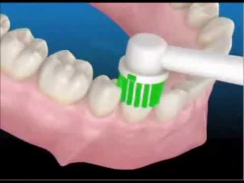 How to use an electric toothbrush 117 Dentist Berkhamsted.