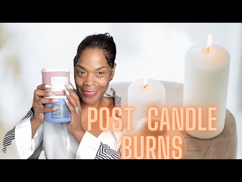 The  Truth Behind  the Classics and New Post Candle Burns #candles