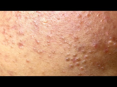 Relax Every Day With Sac Dep Spa #0210