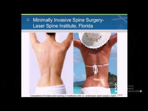 MIS TLIF - Expandable Cage Technology by Khalid M. Abbed, M.D.