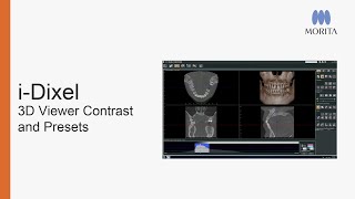 Learn how to improve image observation by adjusting the presets and contrast of your CT images in i-Dixel.