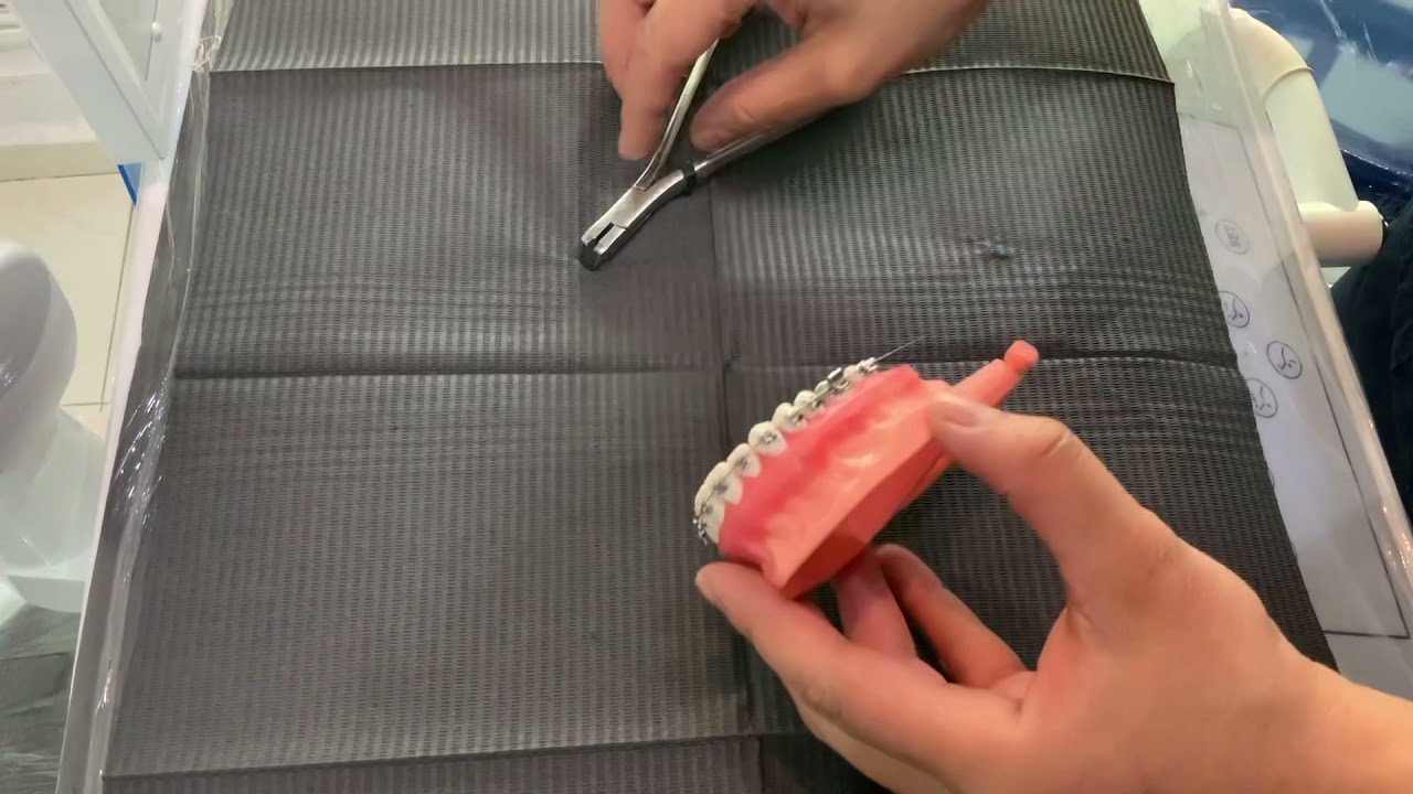 Cómo utilizar una pinza de corte distal