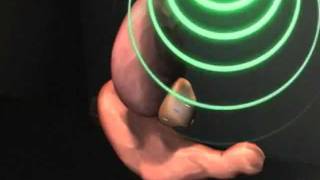 AROS uses Calypso radiation system for treating prostate cancer.
