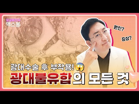 광대뼈수술 후 부작용, 광대불유합?! 광대불유합에 대한 모든 것!