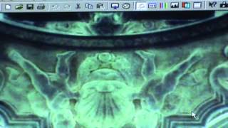 Sitting Frog Giving Birth...