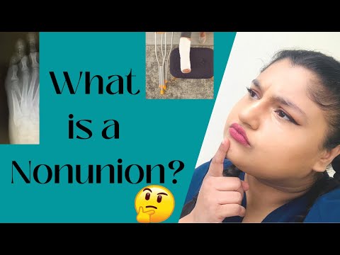 What is a nonunion?