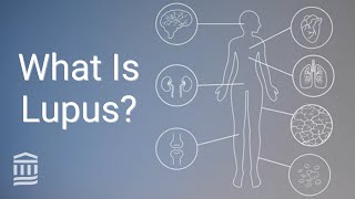 Download lagu Understanding Lupus: Causes, Symptoms, Treatment, and Flare Ups | Mass General Brigham mp3