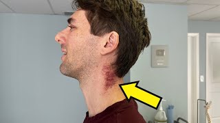Man Goes To Doctor With A *Severely FROZEN* NECK 😫 Lightheaded, DIZZY, Ear Ringing 😫 Needs Help!