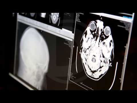A Killer's Brain: Scans Look for Clues to Violence