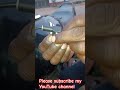 Honda Shine Choke Lever Fitting Youtubeshorts Shine Honda Viral Automobile Hondashine Bike
