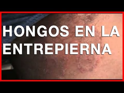 Ahi gli eczemi rispondono su filosofia Magnesie e psoriasi
