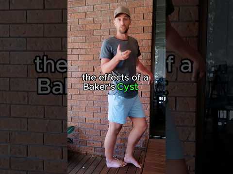 Baker's Cyst? Do THIS!