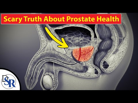 Prostata-Massage Penis Infusion von Brennnessel Prostatitis