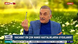 Tıbbi Nebevi - Hacamat en çok hangi hastalıklarda uygulanır ?