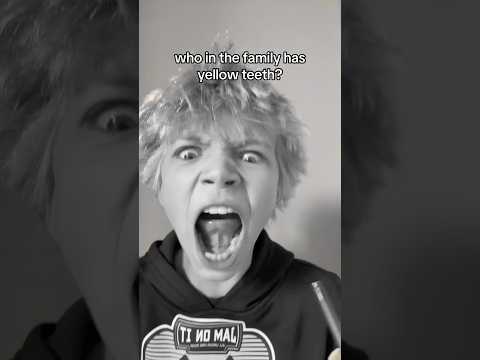 Who in the family has yellow teeth??