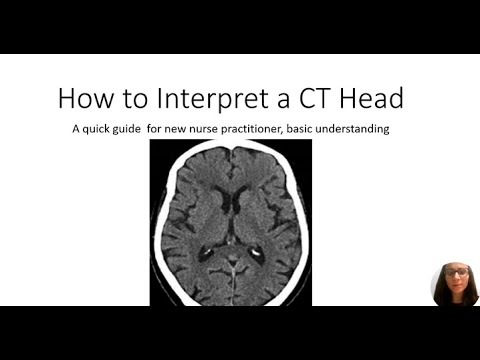 CT Head Basic Interpretation, Easy, Quick, & Simple: Under 10 minutes
