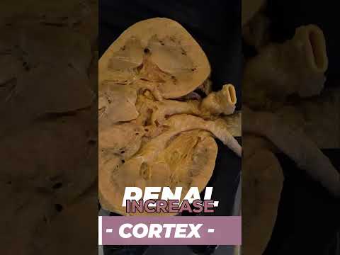 Caffeine Really Makes You Pee More?