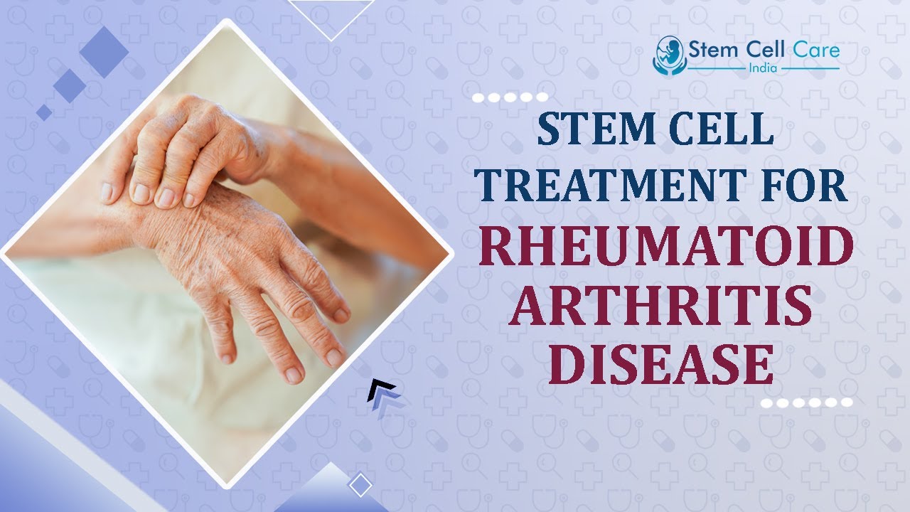 Rheumatoid Arthritis Treatment In India | Stem Cell Therapy For Rheumatoid Arthritis | Exosome |