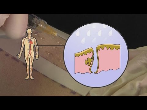 Farmaco ernia intervertebrale Come alleviare il dolore nel giunto sul alluce