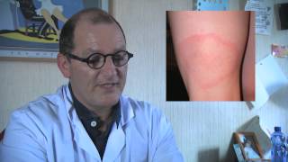 La Tique, le risque de maladie de Lyme: danger ! Que faire ?