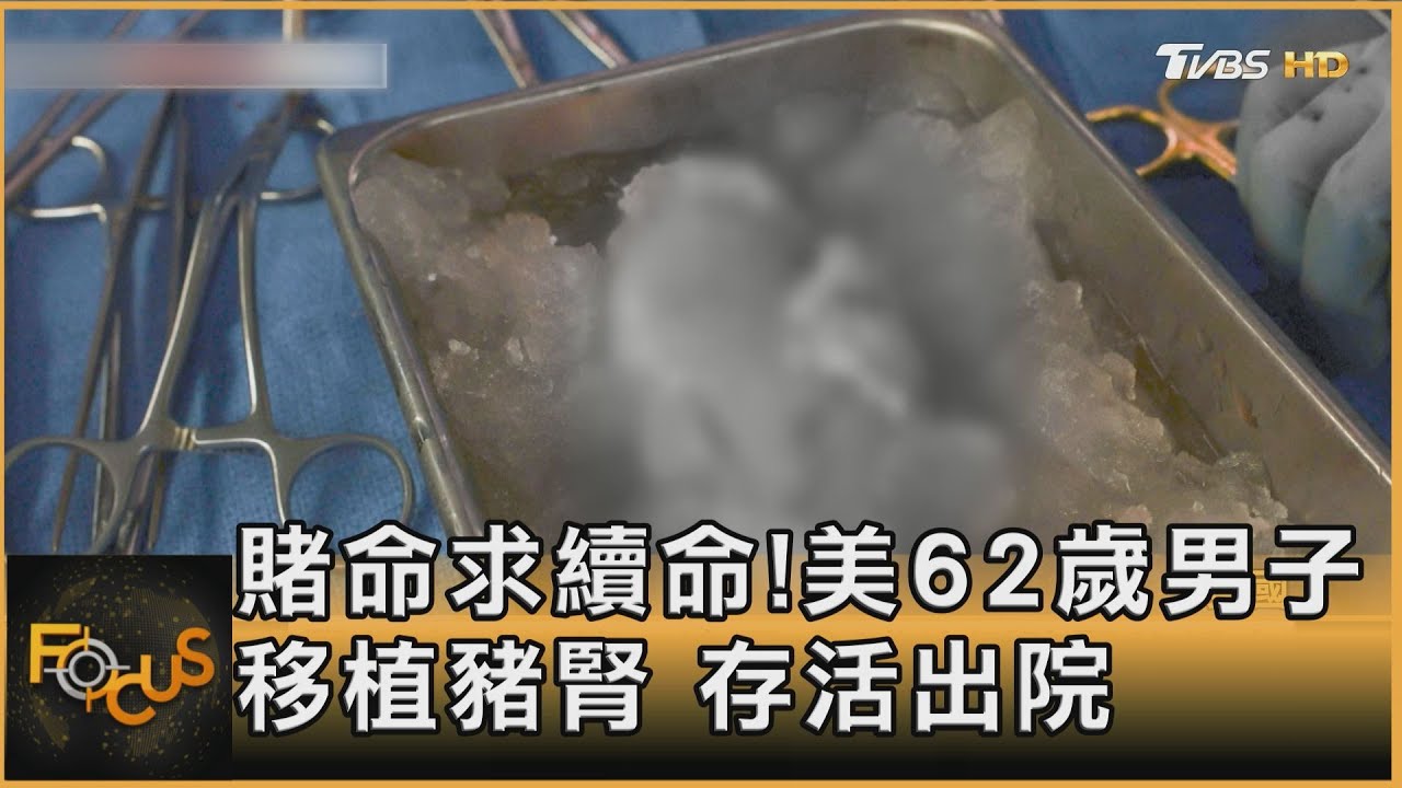 賭命求續命!美62歲男子移植基改豬腎 存活出院