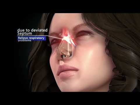 Rhinoplasty Surgery Animation | DR.S.SIVAKUMAR. | Shivani Medical Centre & Covai Cosmetic Surgery