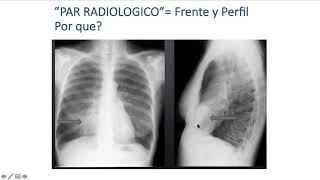 Neumopatía Aguda (Dra. Cecilia Chao) - Módulo Respiratorio