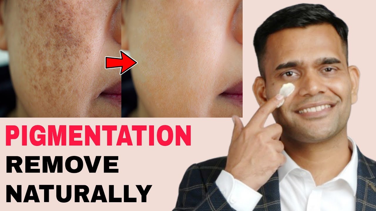 Get Rid Of Pigmentation, Darkspots | Remove Pigmentation in Just 2 Steps