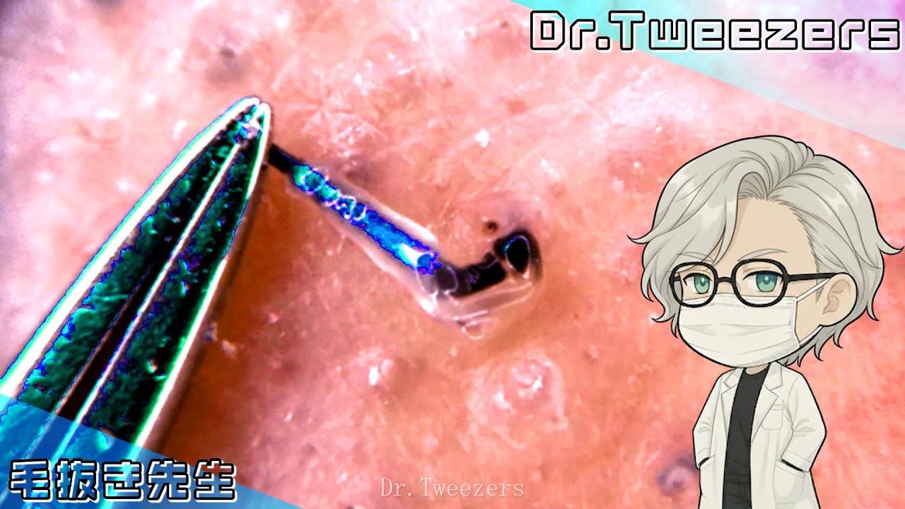 Observing the structure of a hair root.