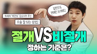 화제의 백만뷰를 뽑은 '그 눈'!!을 만들어낸 원장님의 수술 방법 대.공.개✨