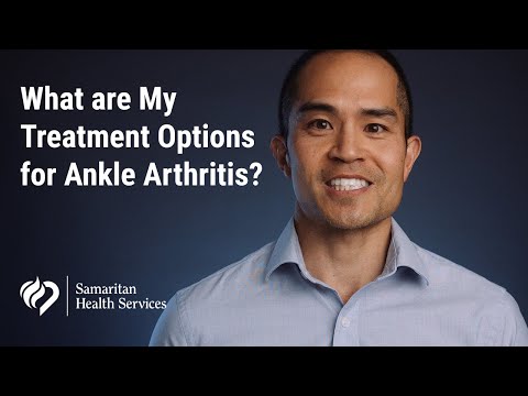 What are My Treatment Options for Ankle Arthritis?