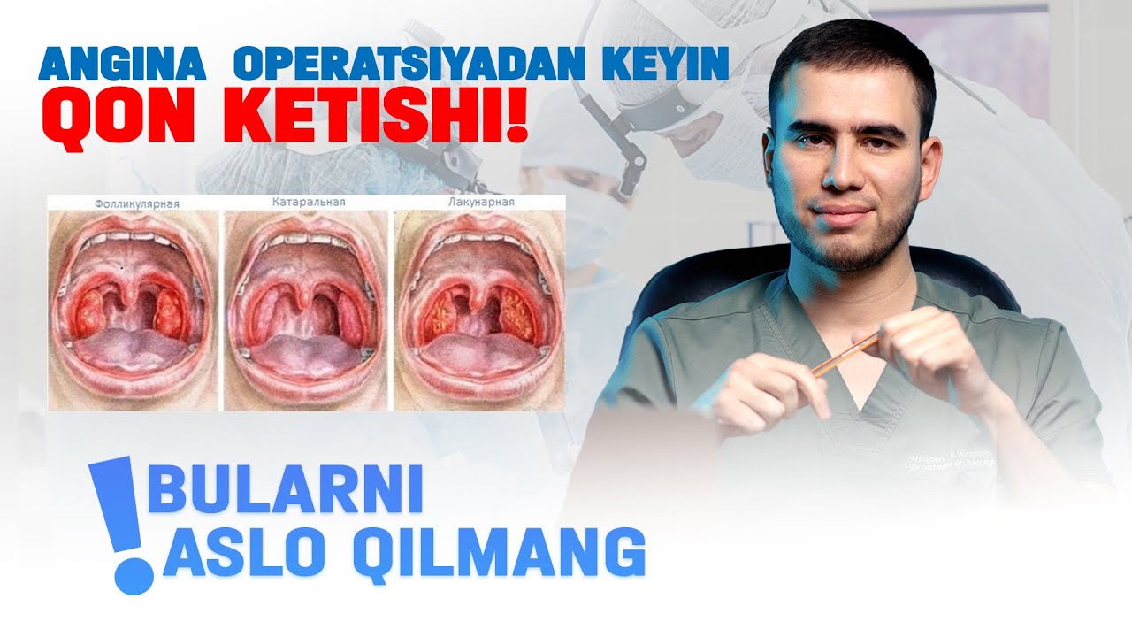ANGINA OPERATSIYASIDAN KEYIN QON KETISHI! |  BULARNI ASLO QILMANG :☎️951888688
