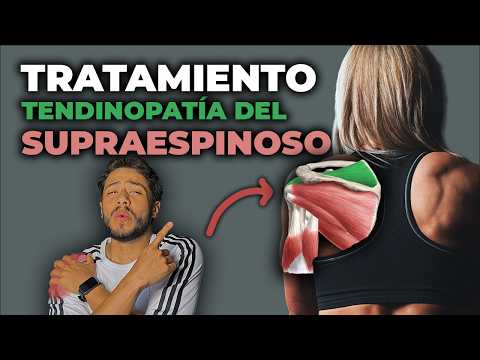 Supraspinatus Tendinitis: Causes, Exercises, Treatment, and Common Mistakes - Complete Guide