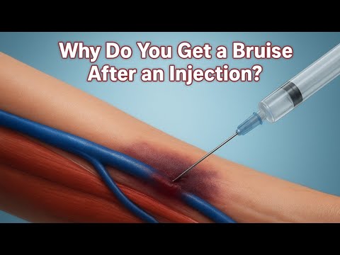 Why You Get Bruises After an Injection | Medical Animation Explained