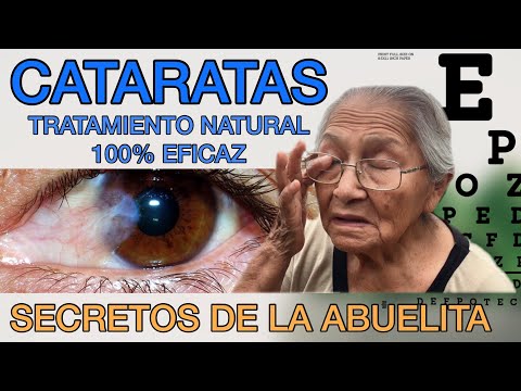 , title : 'CIRUGIA DE CATARATA - Cómo evitarla - TRATAMIENTO NATURAL 100%  EFICAZ - Secretos de la Abuelita'