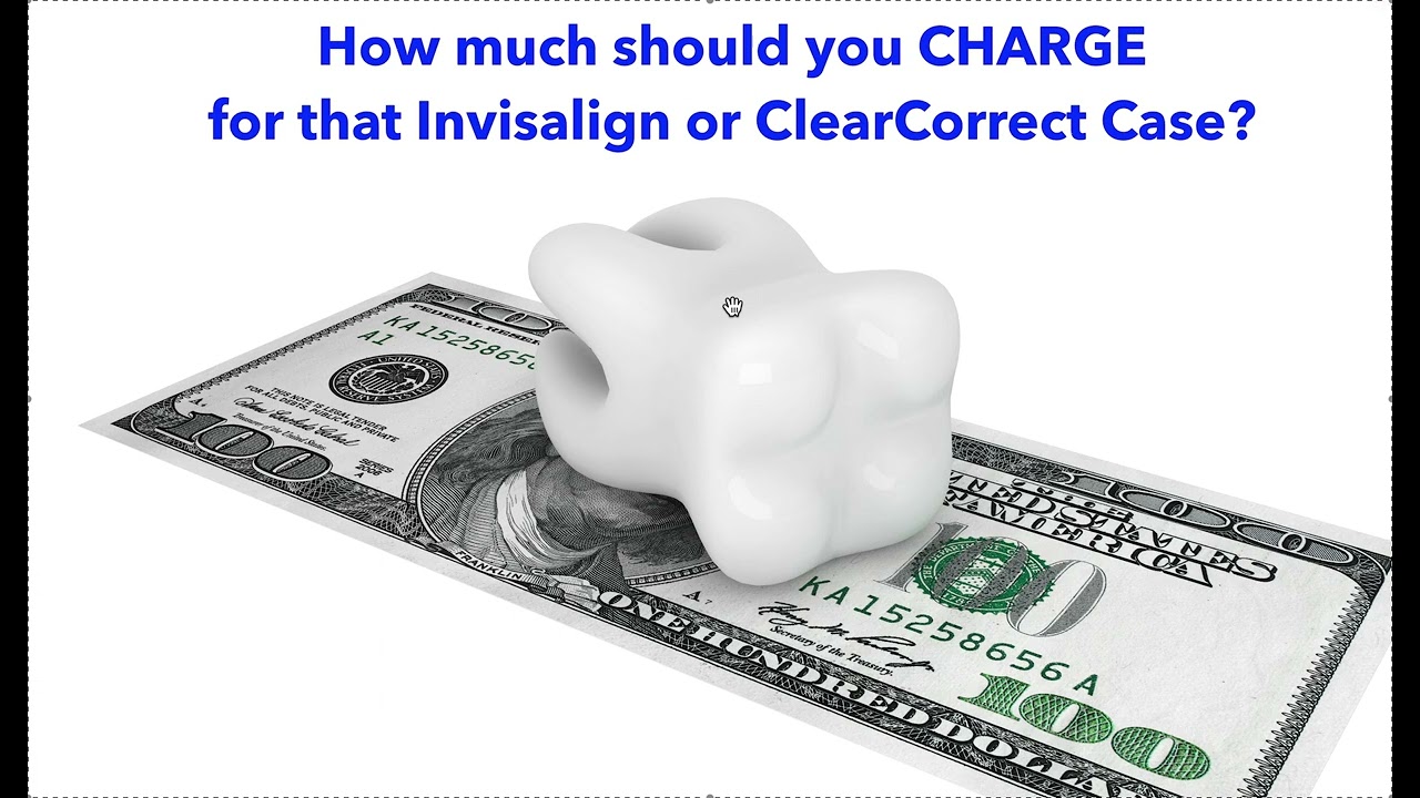 How much should you CHARGE for that Invisalign, ClearCorrect or Braces Case?