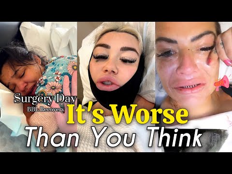 BBL Pain Is Real… And It’s Worse Than You Think