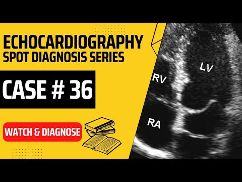 Echo Case 36: Echocardiography Spot Diagnosis Series - Learn Echo with Labelled findings