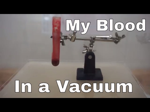 What Happens When I Put My Own Blood In A Vacuum Chamber? Will It Boil Or Turn Blue? Video