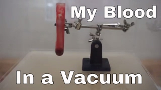 What Happens When I Put My Own Blood In A Vacuum Chamber? Will It Boil Or Turn Blue?