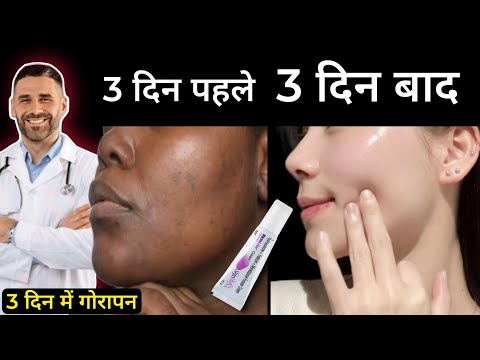 Finished product skin whitening cream skinlite, packaging ty...