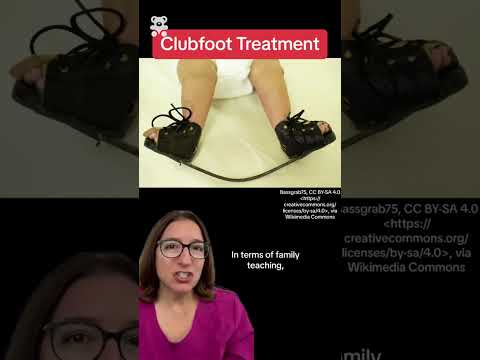 Clubfoot: Pediatrics SHORT | @LevelUpRN