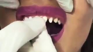 Snap On Smile Oujda 😀