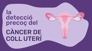La detecciÃ³ precoÃ§ del cÃ ncer de coll uterÃ­ amb automostra